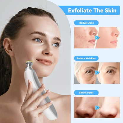 Upgraded Diamond Microdermabrasion Machine White USB Powered Skincare Device-1