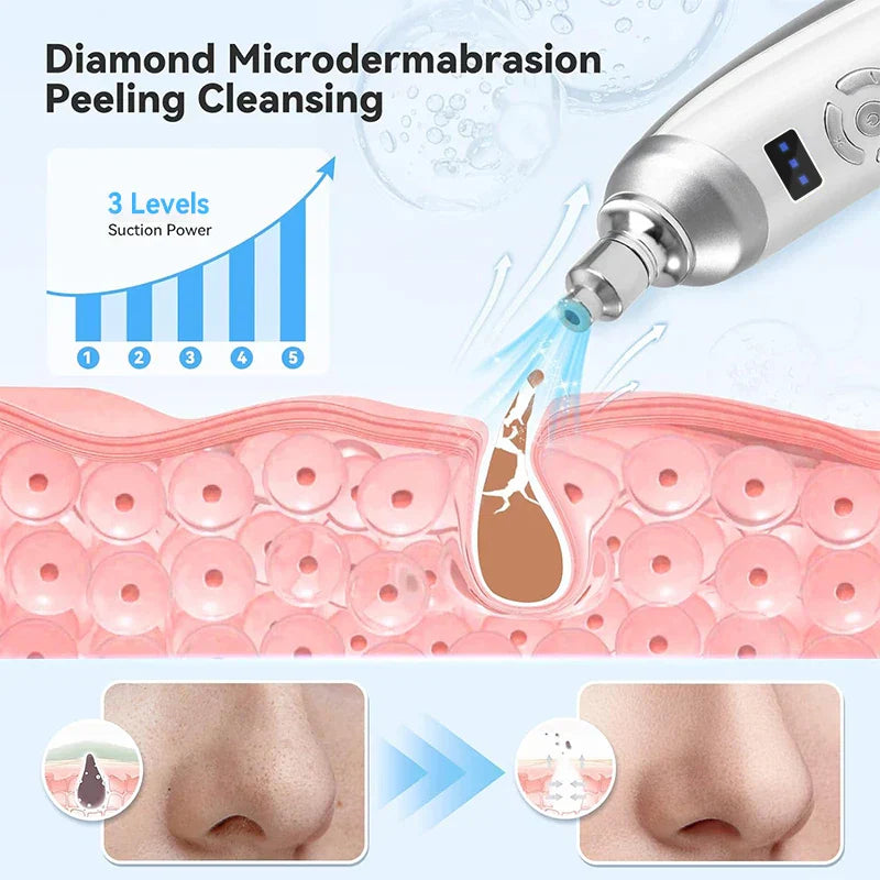 Upgraded Diamond Microdermabrasion Machine White USB Powered Skincare Device-2